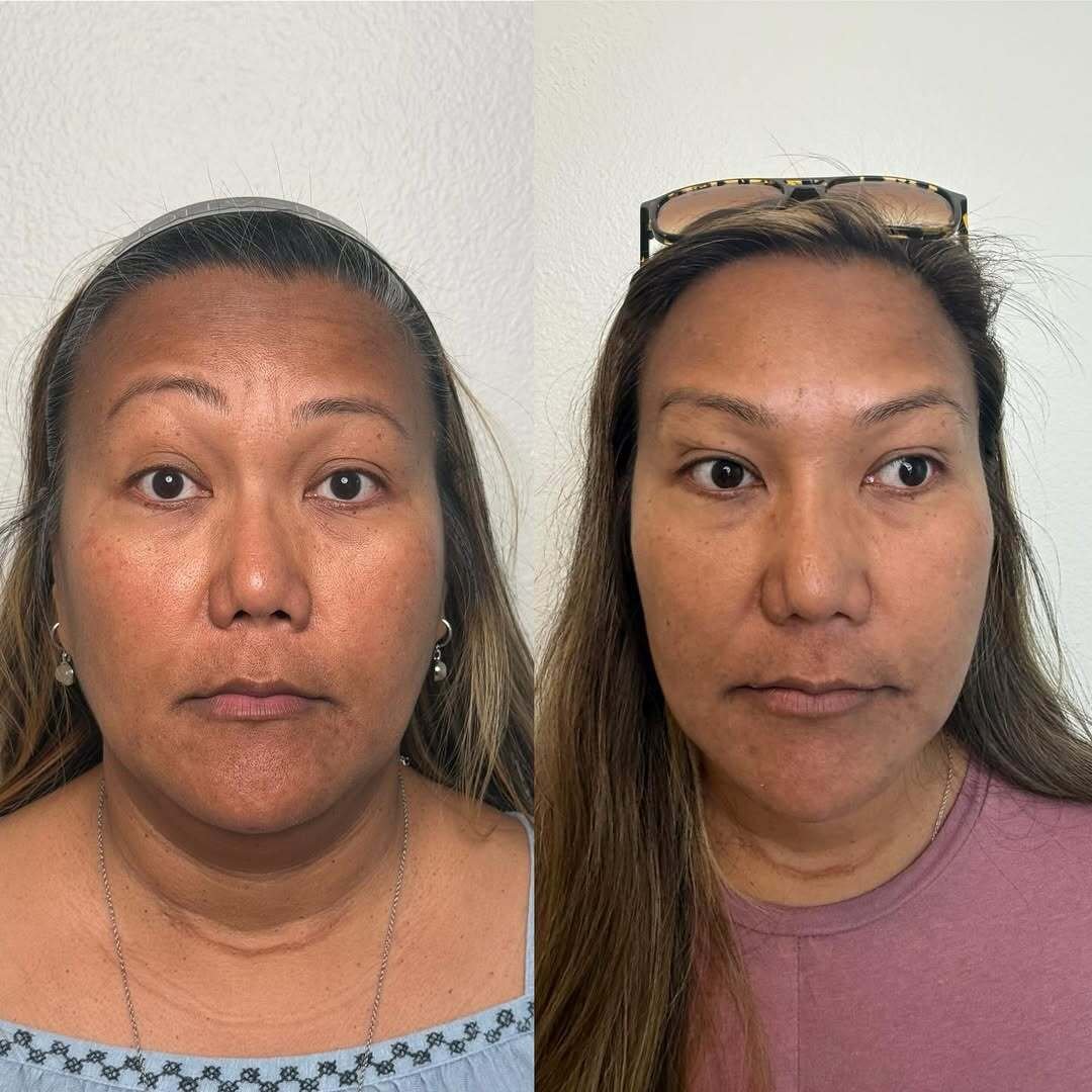 14-04-2025