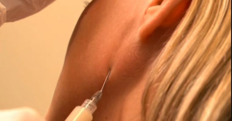 Dermal-Fillers-+-Biostimulatorsjpg-crop-1