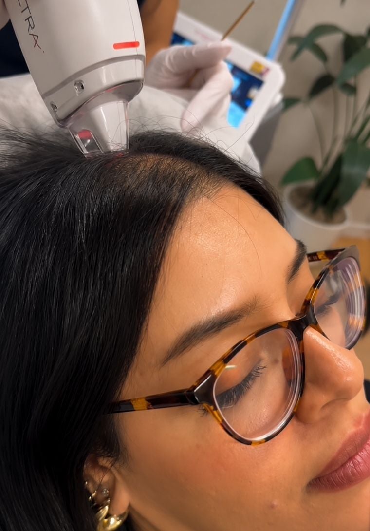 Hair Restoration Device