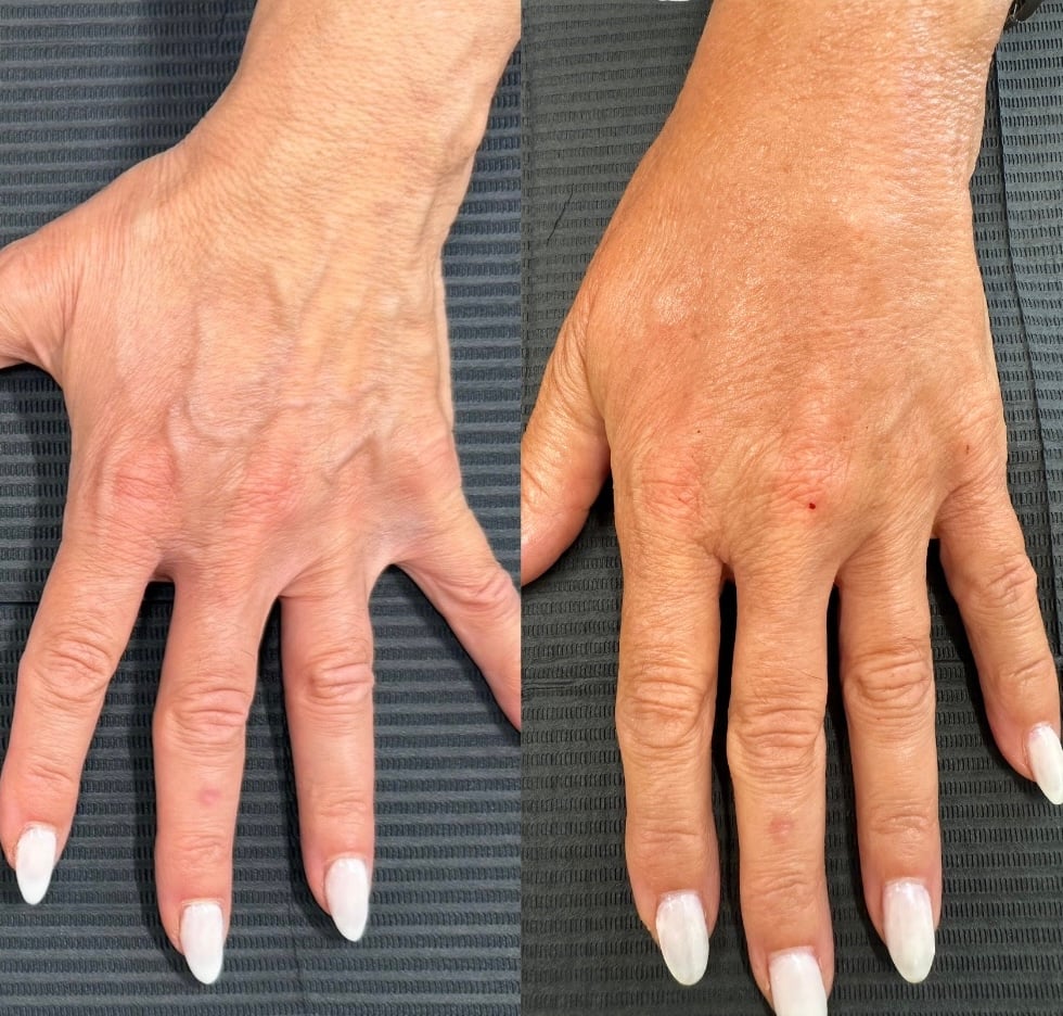 SKINSATION BEFOREAFTER TEMPLATE