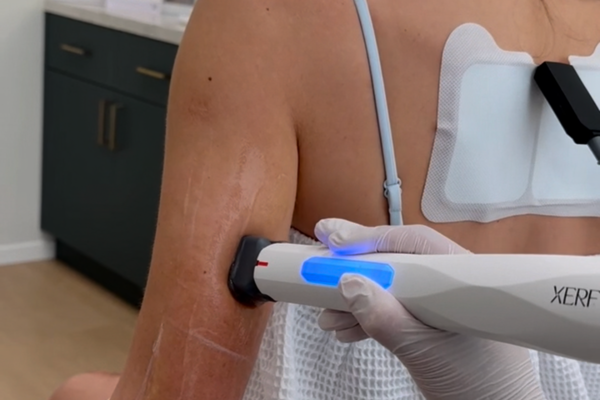 xerf-treatment-on-arms