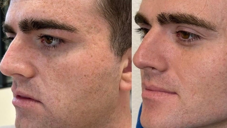 scars-2 scars-2